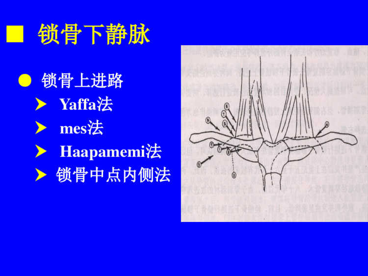 经皮中心静脉置管术PPT