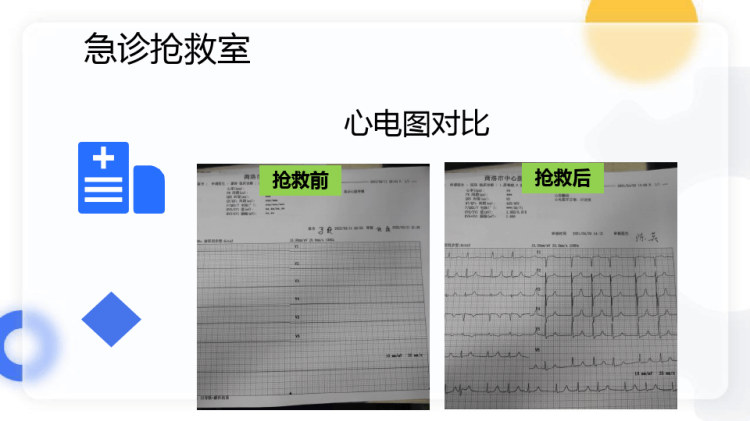 一例心脏骤停病人的抢救护理体会PPT