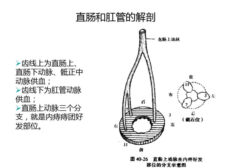 外科学PPT结直肠肛管直肠疾病结肠癌直肠癌手术治疗PPT