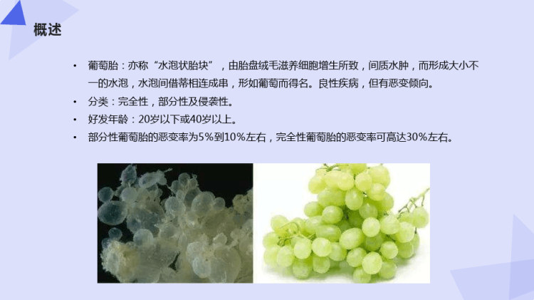 葡萄胎绒毛癌胎盘残留的影像诊断与鉴别诊断PPT