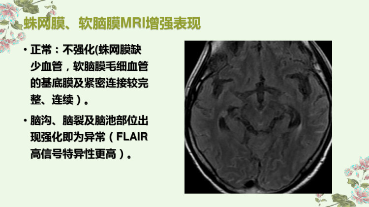 脑膜的正常MRI增强表现PPT