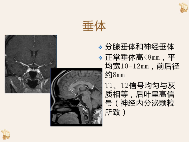 鞍区肿瘤的影像诊断与鉴别诊断PPT