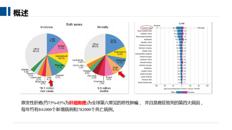 肝细胞癌的MRI影像诊断PPT