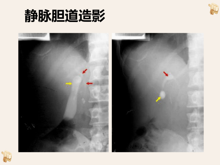 消化系统的影像诊断PPT