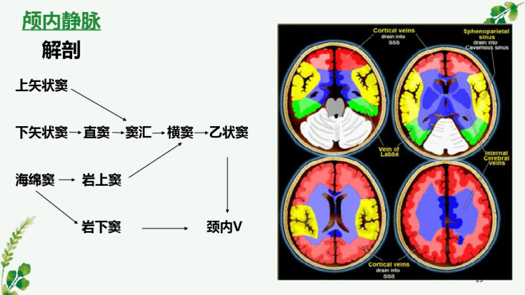 颅内静脉构成与静脉窦血栓形成影像诊断PPT