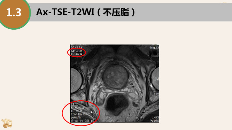 男性盆腔MRI检查规范PPT