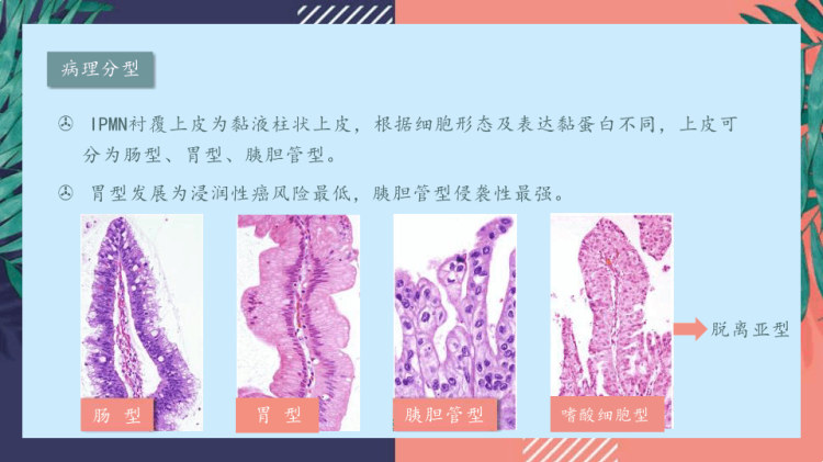 胰腺导管内RU头状黏液性肿瘤的影像诊断与鉴别诊断PPT