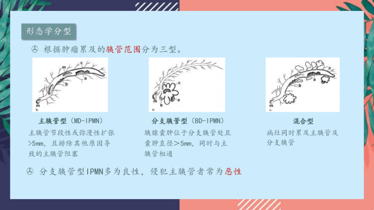 胰腺导管内RU头状黏液性肿瘤的影像诊断与鉴别诊断PPT