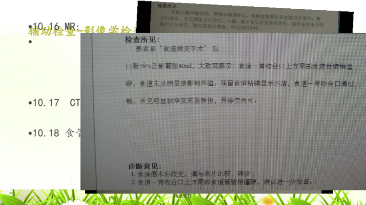 一例上消化道出血病人的护理查房版本PPT