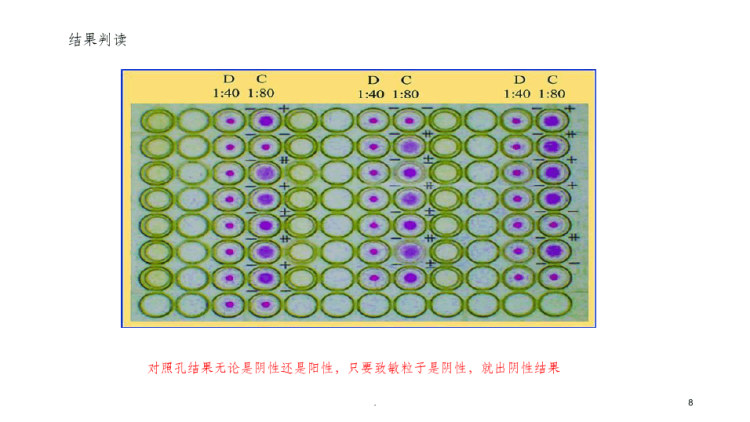 梅毒螺旋体特异性抗体检验PPT