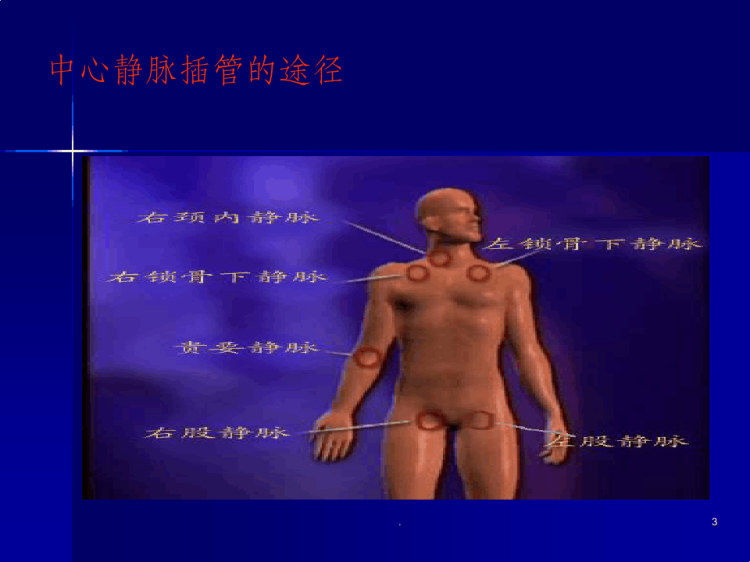 深静脉置管术PPT