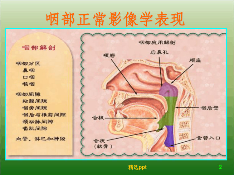 儿童腺样体肥大影像表现及诊断标准PPT