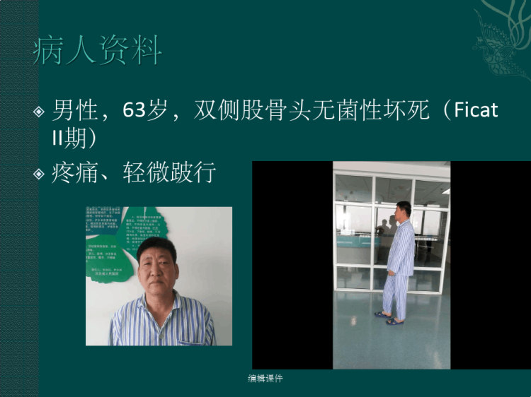 羟基磷灰石减压棒治疗股骨头坏死及股骨颈骨折PPT