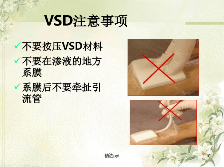 封闭负压引流术的护理流程PPT