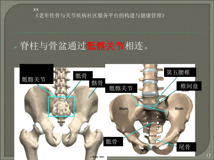 如何预防腰背痛PPT