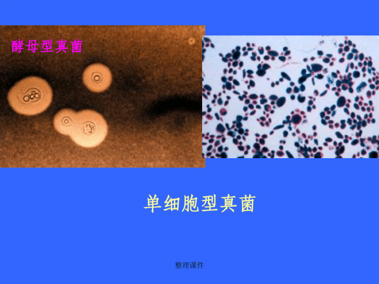 真菌总论PPT