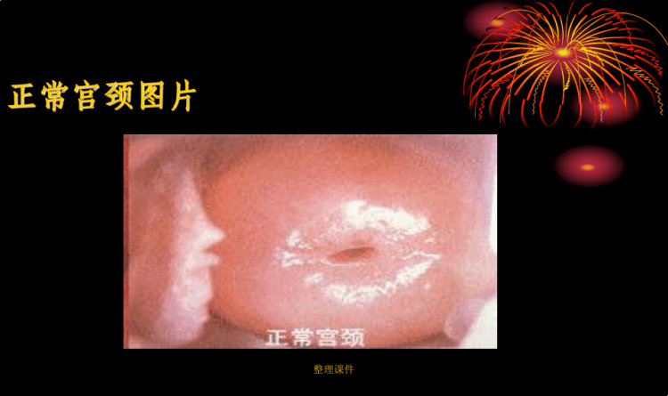 《女性保健知识讲座》PPT