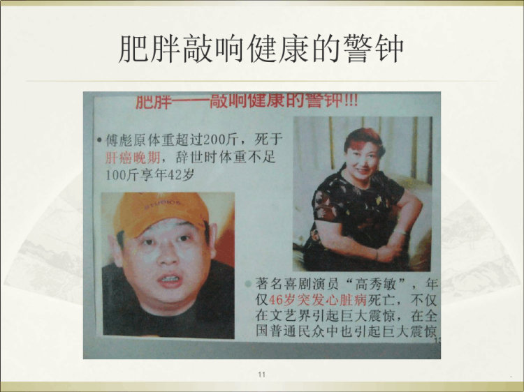 健康课堂之临床合理诊疗肥胖症PPT