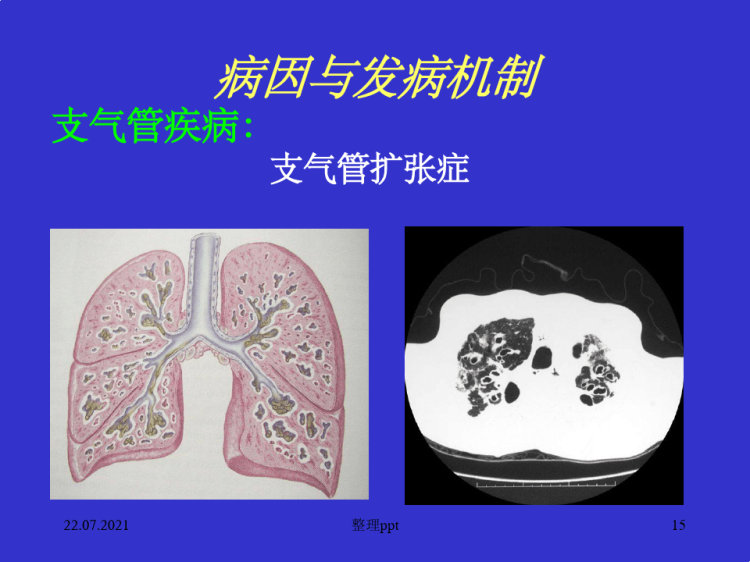 呼吸系统诊断学PPT