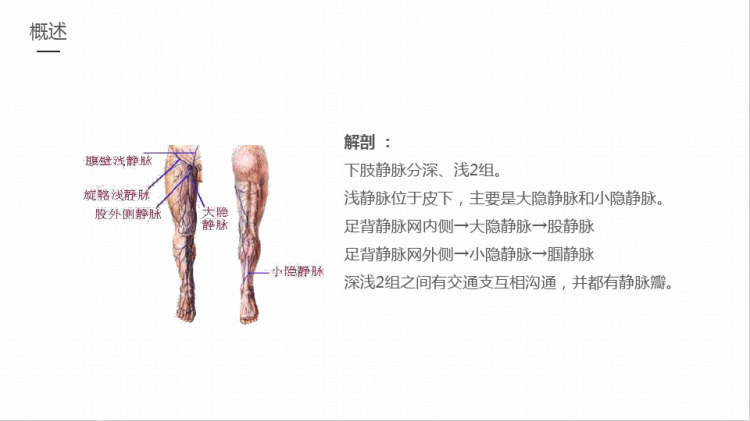 下肢静脉曲张护理PPT