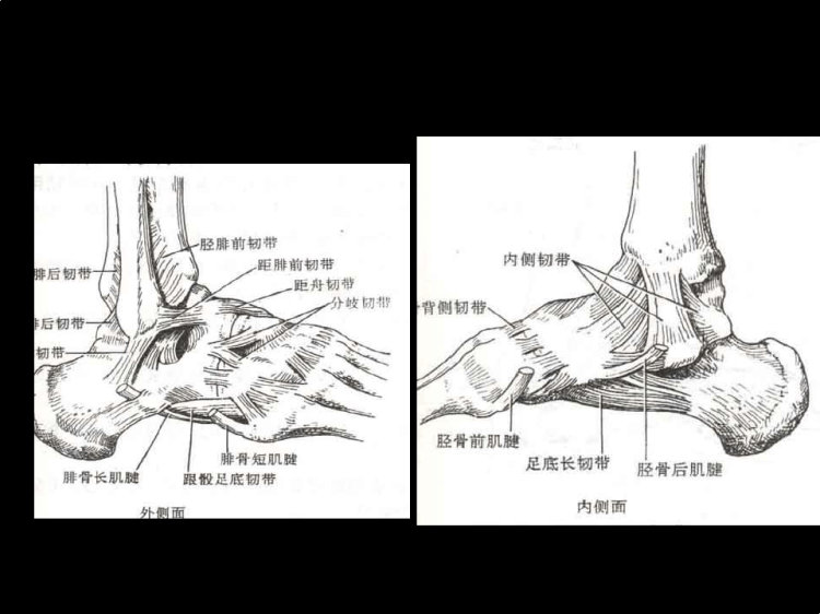 踝关节骨折讲义PPT