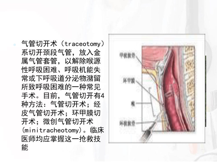 气管切开病人的护理PPT