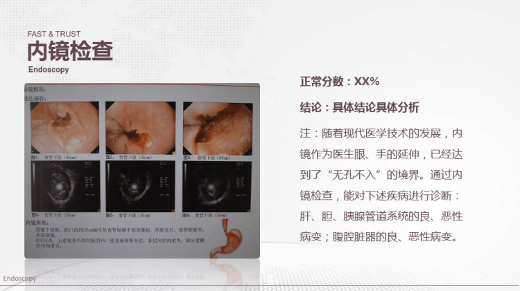 病例汇报PPT