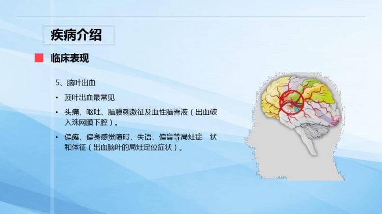 脑出血术后护理查房PPT