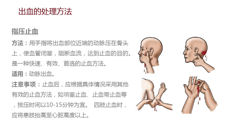 出血的观察与护理PPT