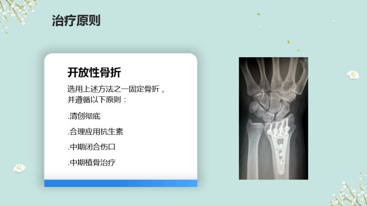 胫腓骨骨折的护理PPT