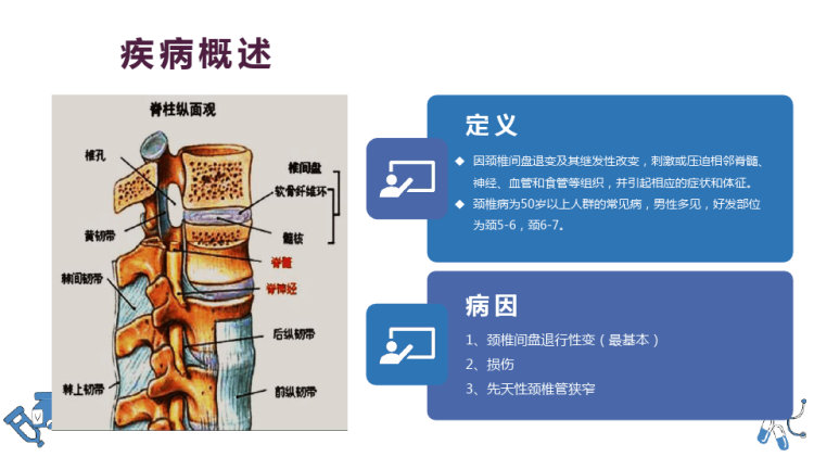 颈椎病护理pptPPT