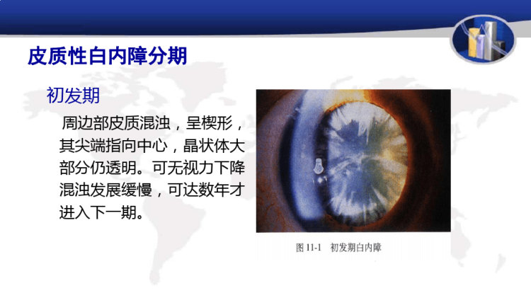 白内障护理PPT