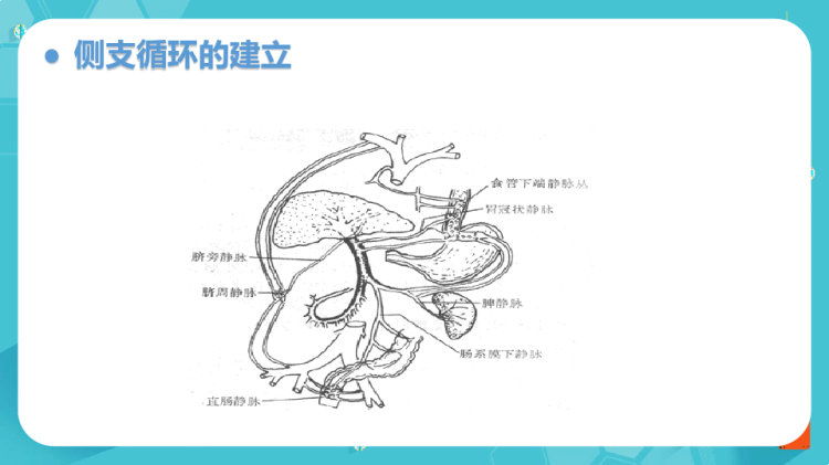 肝硬化护理查房PPT