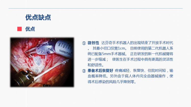 达芬奇手术机器人手术配合PPT