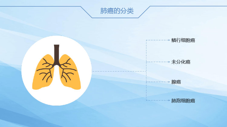 肺癌根治术后护理查房PPT