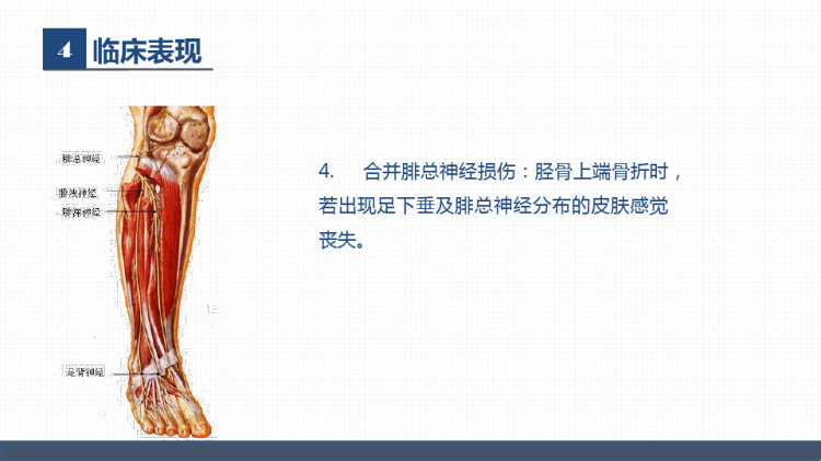 骨科胫腓骨骨折教育查房PPT