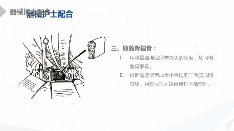 经前路腰椎手术的综合护理PPT