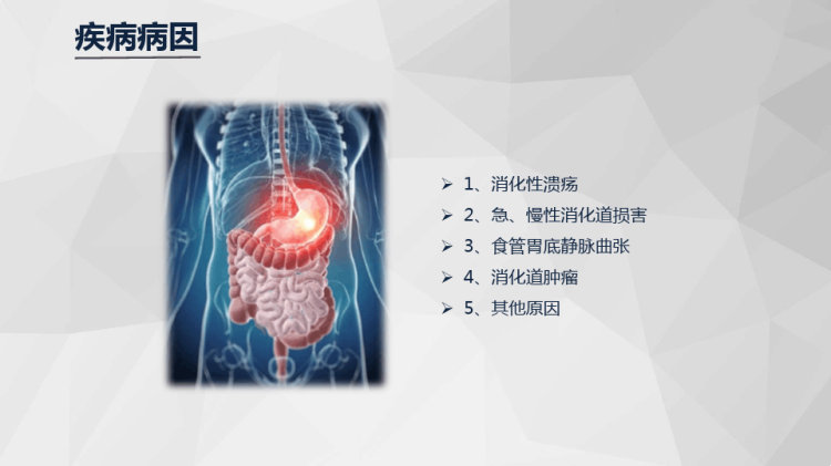 消化道大出血急救与护理知识护理PPT