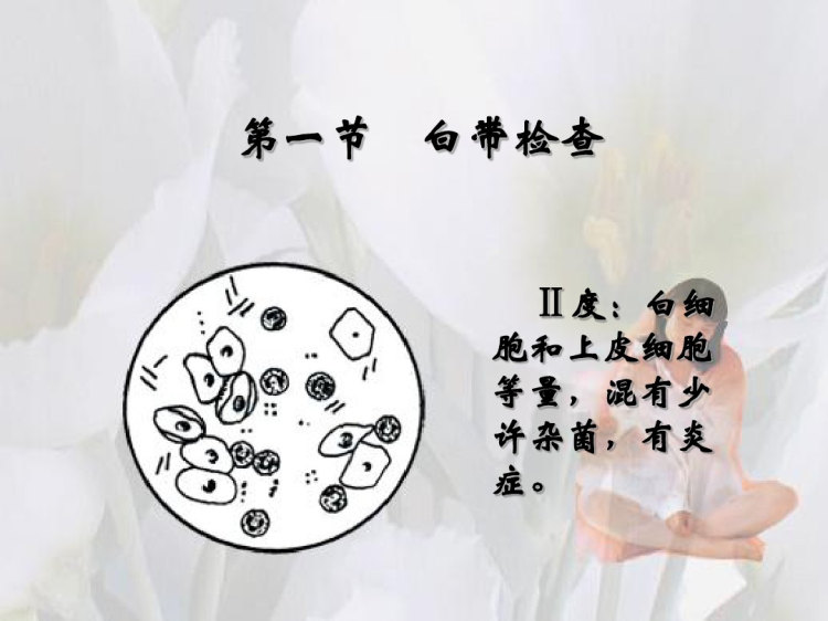 特殊检查PPT