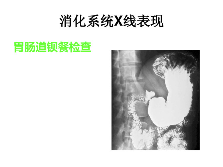 影像学病例PPT