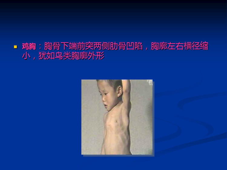 胸部评估正式版本PPT