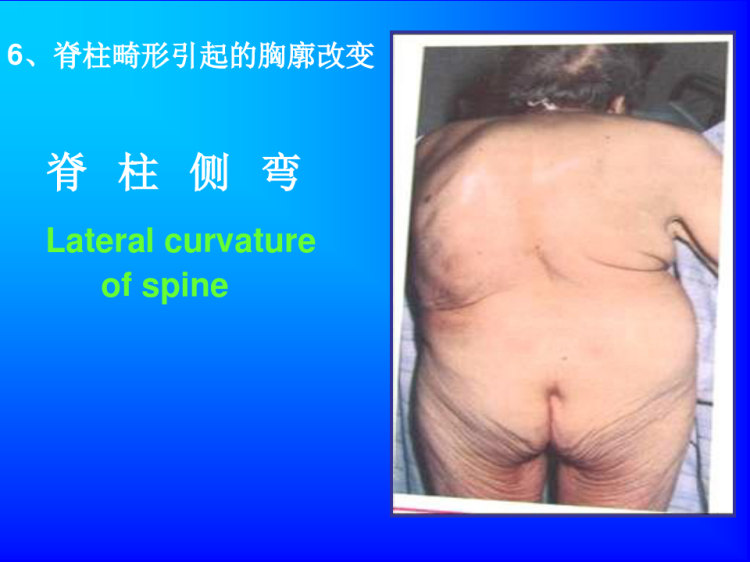 胸部评估正式版本PPT
