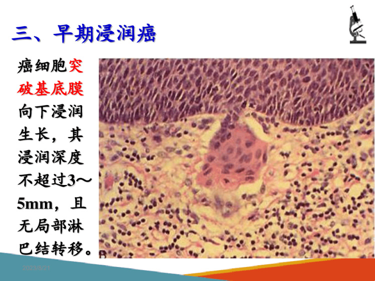 药理学：抗寄生虫药抗阿米巴病药PPT