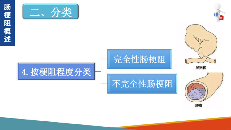 外科学：腹部疾病肠梗阻PPT