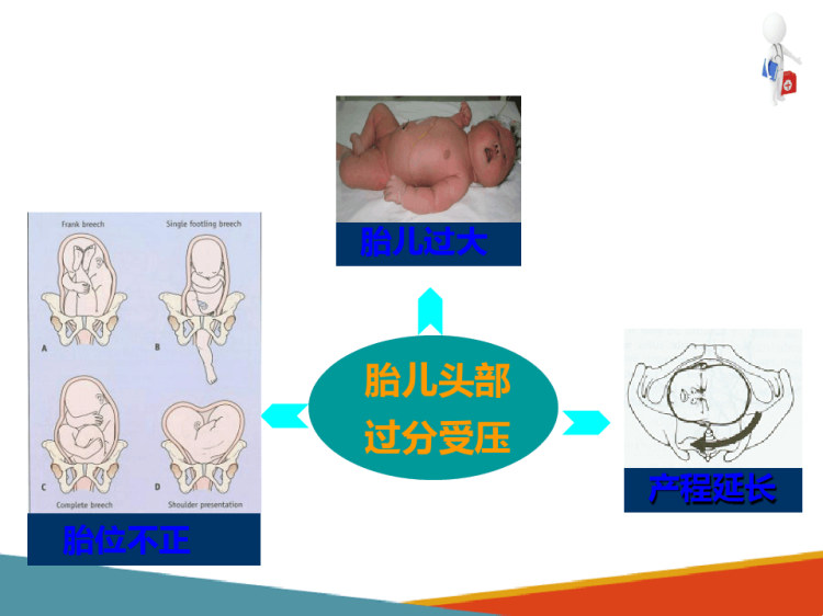 儿科学：新生儿及新生儿疾病新生儿颅内出血PPT