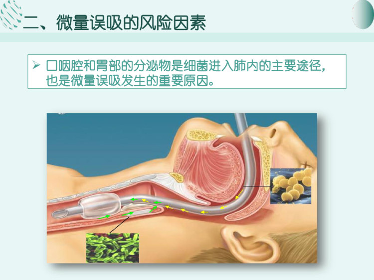 气管插管微量误吸PPT